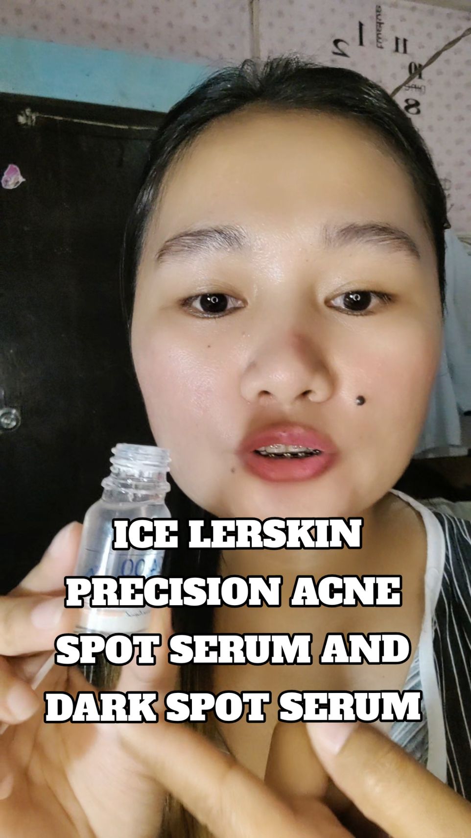 Replying to @ysanggggyah If may question kapa about ICE LERSKIN FOR ACNE, comment lang para masagot kita🤗 #icelerskinph #icelerskin #acnetreatment 