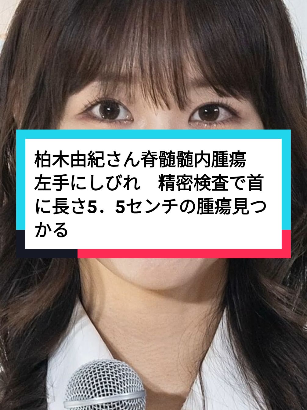 柏木由紀さん脊髄髄内腫瘍　左手にしびれ　精密検査で首に長さ5．5センチの腫瘍見つかる #ニュース #news #柏木由紀 