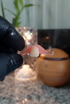Single Tooth Removable Partial Denture 🦷🤹🏻‍♂️✨️