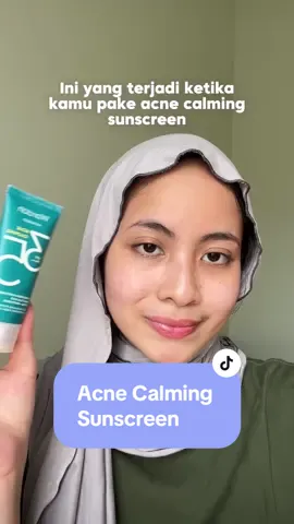 UV Shield Acne Calming Sunscreen Moisturizer SPF 35 PA+++ Bantu melindungi kulit dari paparan sinar matahari berlebih dan bantu menenangkan kulit kemerahan ☀❤ #WardahSkincare #WardahUVShield  #moistawaitedglow 