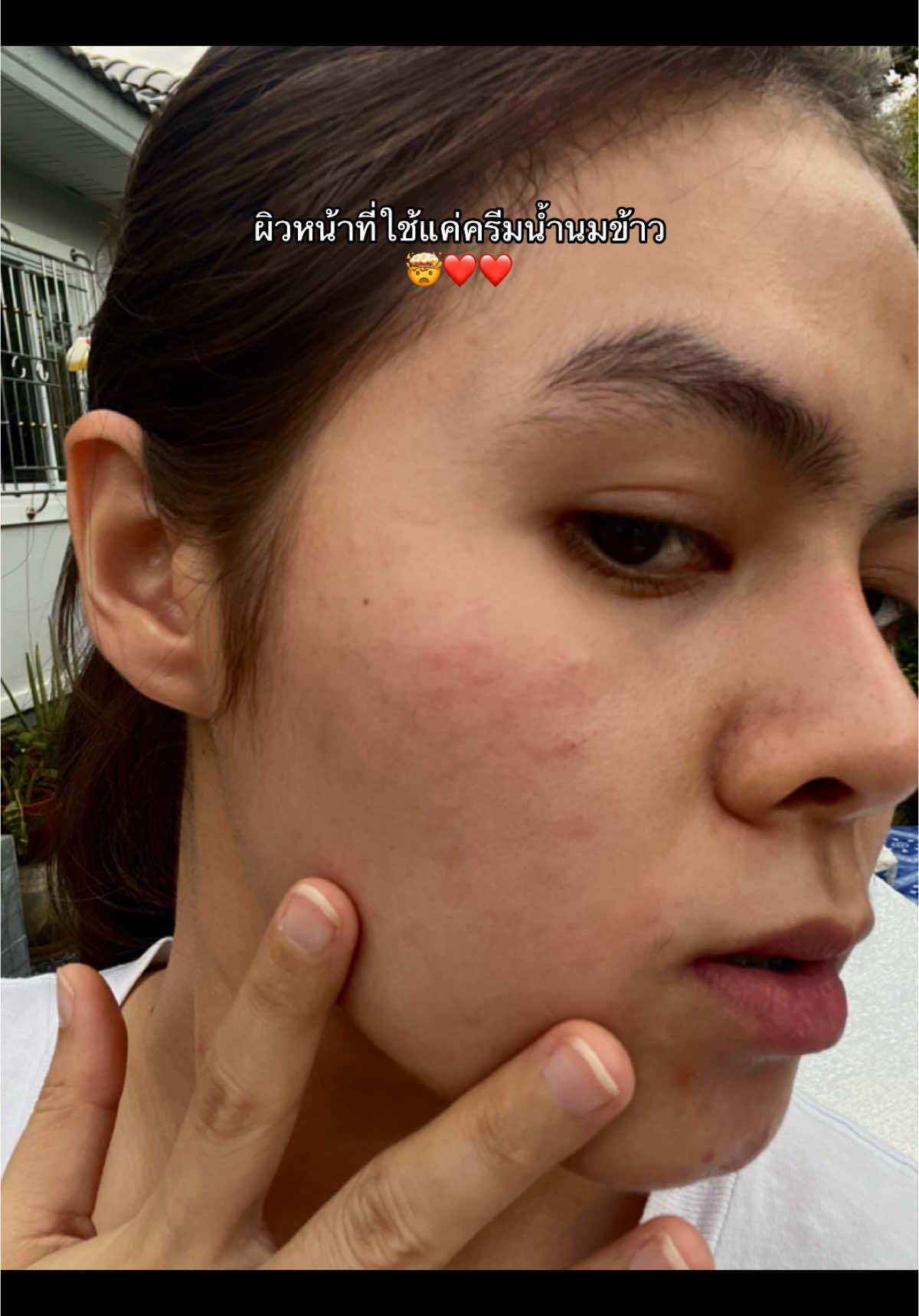 หน้าเนียนมาก #ครีมน้ํานมข้าว #ครีมน้ํานมข้าวสุรนุช #ครีมลดสิว #skincare #ฟีดดดシ 