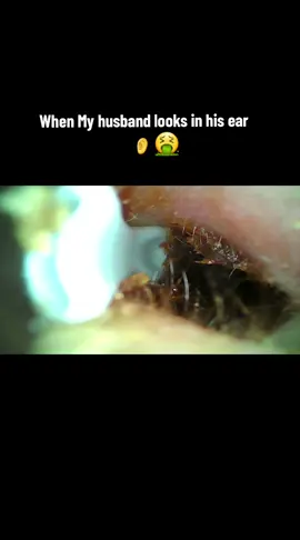 @VITCOCO #earwax #earwaxremoval #yuck #crazy #everyone #needthis #vitcoco #ears #musthave #musthaveproducts #buynow #fyyy #fyyyyyyyyyyyyyyyy #fyy 