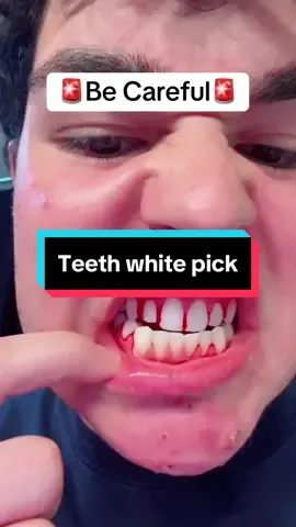 faster way to get white teeth #whiteteeth #yellowteeth #waterpick #howtogetwhiteteeth #dentalhygienist #dentalhygiene #CapCut 