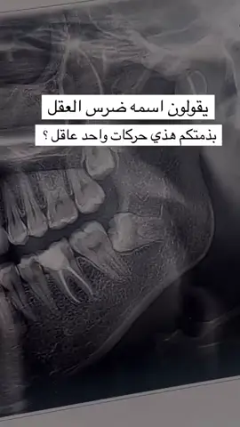 #منوعات_تيك_توك 