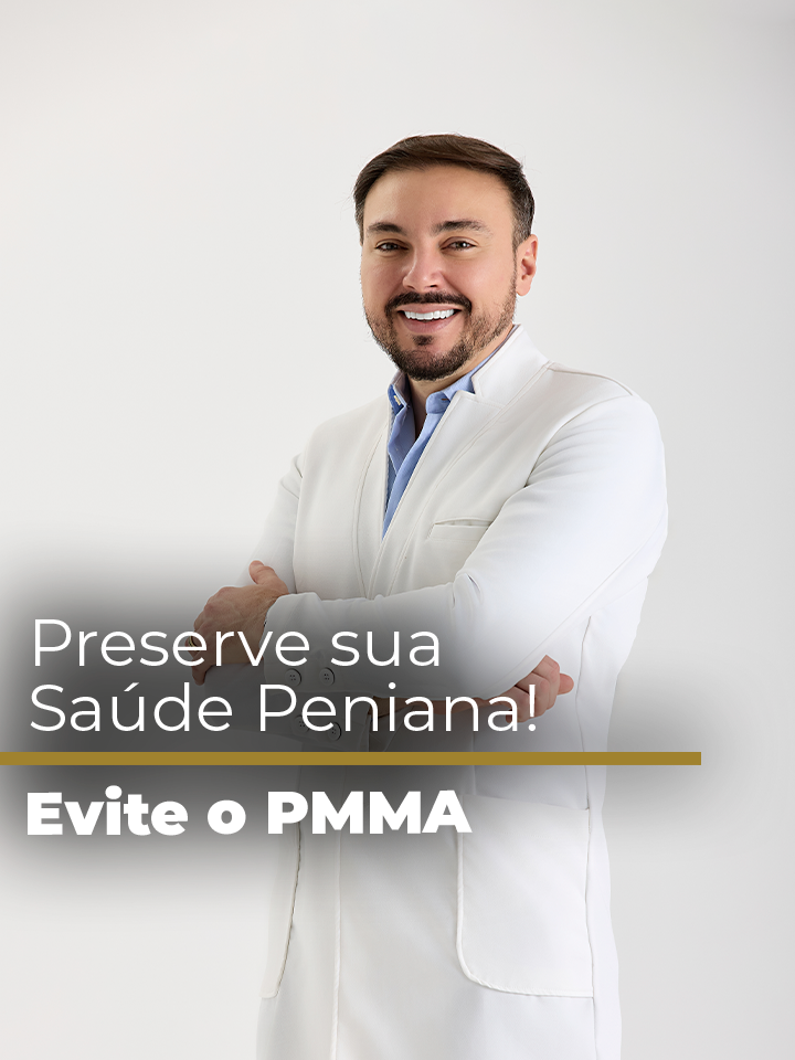 Tenho recebido muitos pacientes que realizaram preenchimento peniano com PMMA, um preenchedor definitivo (um plástico) que pode causar danos irreversíveis à estética do pênis.  O PMMA não é recomendado por profissionais sérios, sendo um produto que só pode ser removido com cirurgia.  Escolher preenchedores temporários, como os que utilizamos na clínica, à base de ácido hialurônico específico para a área íntima, é essencial para a segurança e saúde.  Sempre procure um urologista de confiança para cuidar da sua saúde íntima.  #SaúdeÍntima #PreenchimentoPeniano #CuidadoComPMMA #EstéticaPeniana #ProcedimentosSeguros #Urologia