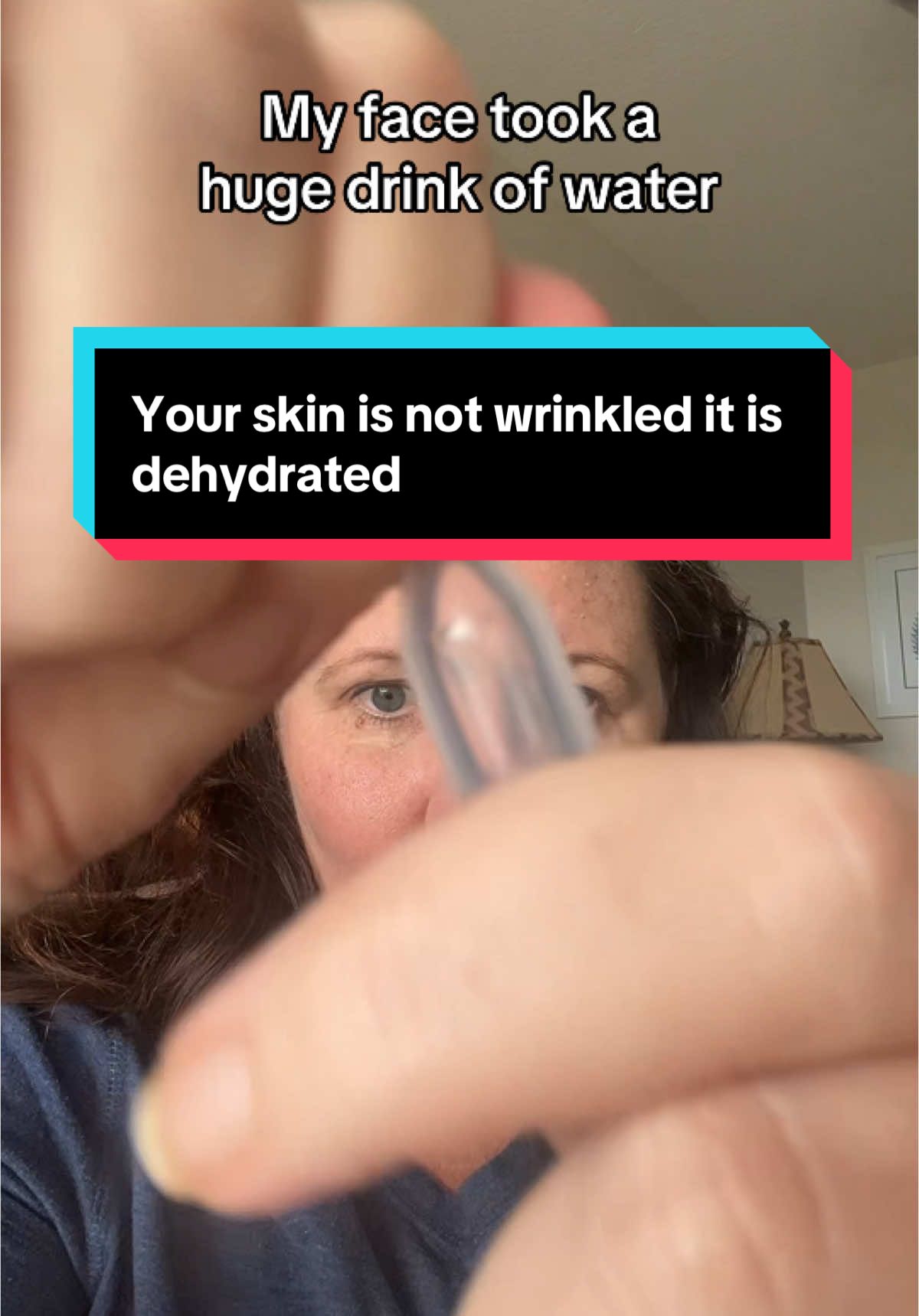 Your skin is not wrinkled it is dehydrated you need this @WNP SKINCARE #hyaluronicacid #hyaluronicacidserum #wnphyaluronicacid #Tiktokshopholidayhaul #tiktokshopblackfriday #tiktokshopcybermonday #christmasgiftideas