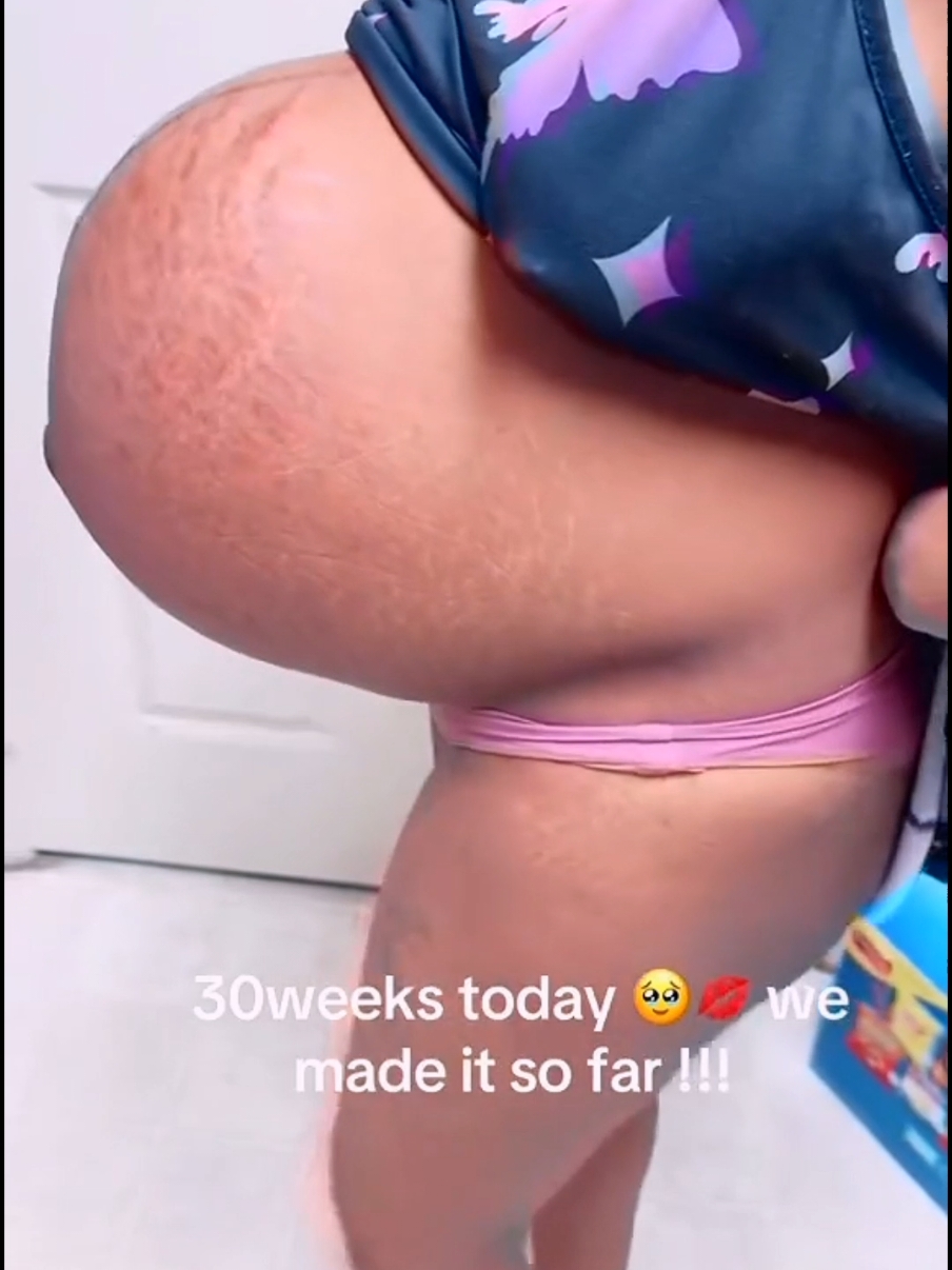 30 weeks triplets #pregnancy #momlife #MomsofTikTok #twins #triplets #pregnantlife #pregnant #ultrasvideos #pregnancyannouncement 