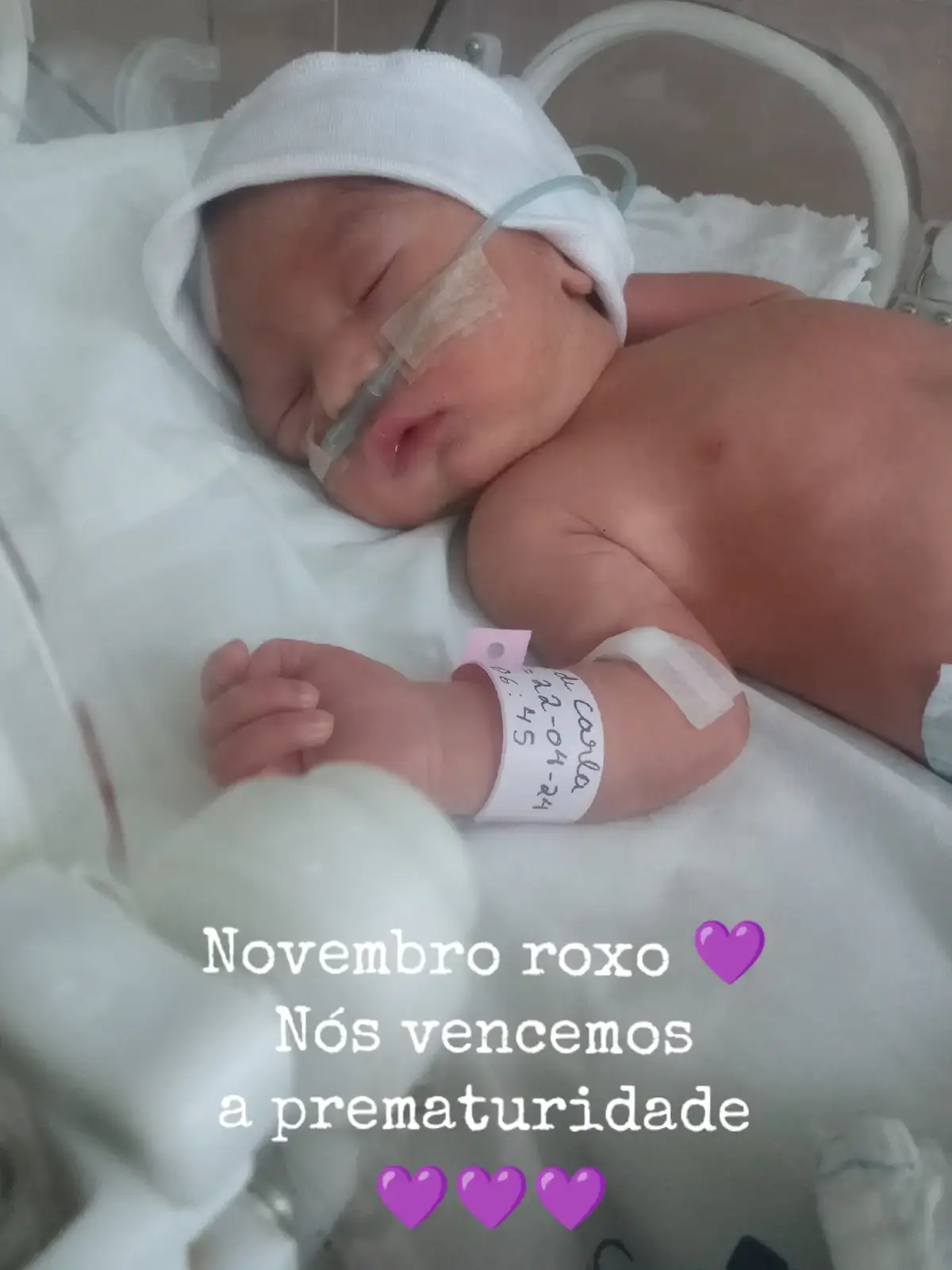 Meu milagre!!! #maedeprematuro  #maternidade  #prematurebaby  #maedeprimeiraviagem  #pierrerobinsequence  #doencasraras  #perdaauditivainfantil 