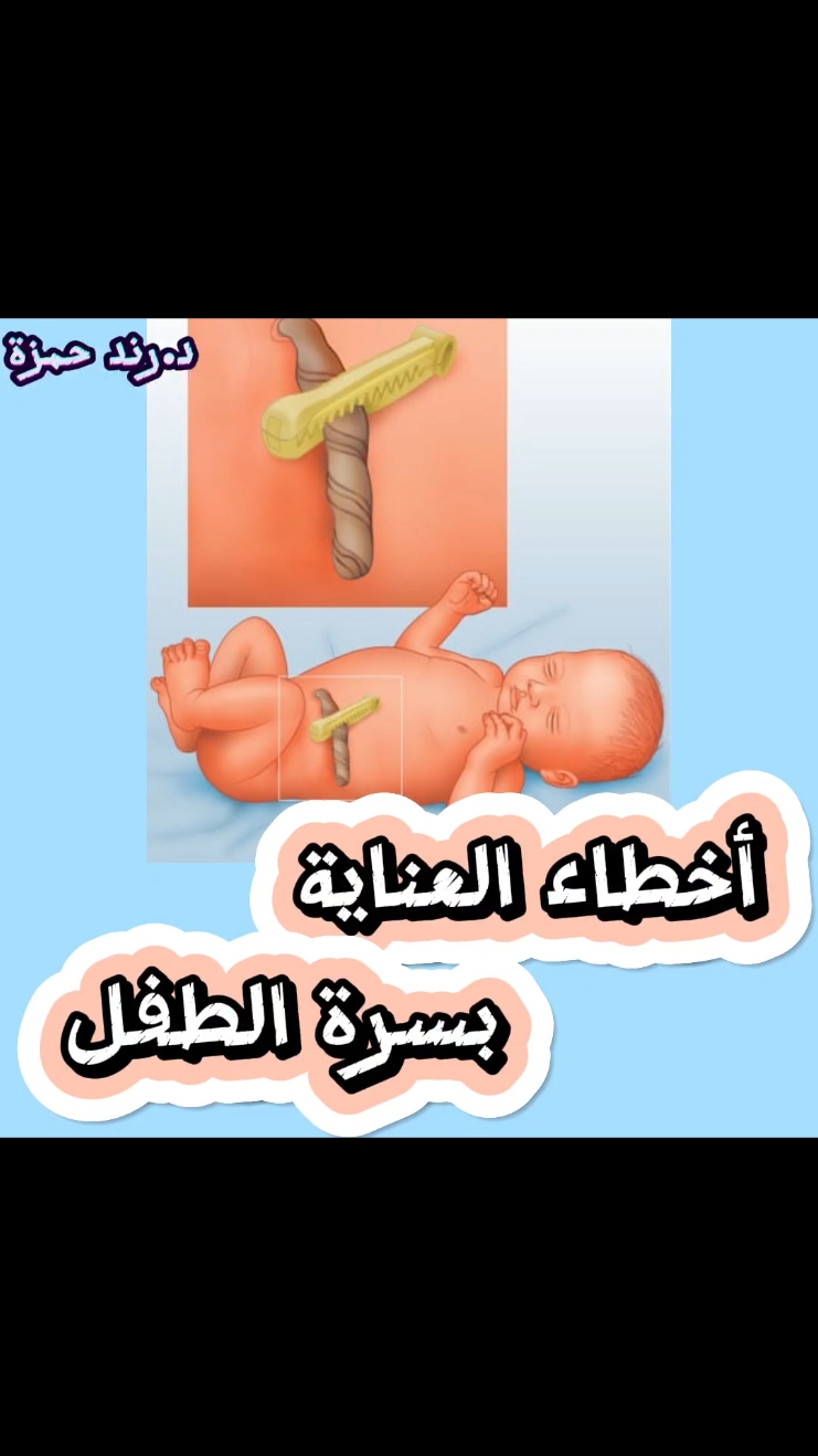 أخطاء العناية بسرة الطفل.. د.رند حمزة صيوان  إختصاص طب الأطفال والخدج وحديثي الولادة شهادة البورد (الدكتوراة) زميلة المجلس العربي للإختصاصات الطبية عضو الجمعية العراقية لطب الأطفال بغداد-نفق الشرطة-خدمي الأطباء- على الشارع العام عمارة ياقوتة فوق صيدلية فن الدواء 07739100079 ###سرة_الطفل #سقوط_السرة #سرة ##دكتورة #عيادة_اطفال #اطفال #طبيب_اطفال #اختصاص #خدج #طب #حديثي_الولادة