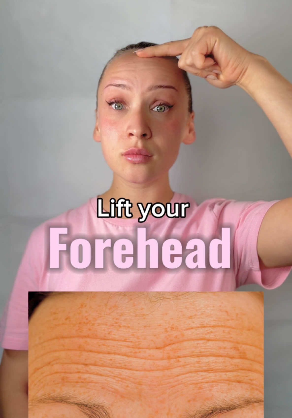 If you want to get significant face lifting within just 14 days, you have to: 1) comment this video with “Face lifting yes”  2) follow me on my instagram account  3) check the highlight “Group Masterclass”  I’ll see there 😘 #foreheadwrinkles #foreheadlift #howtoliftface #facelifting #facefitness #wonderfacefit 