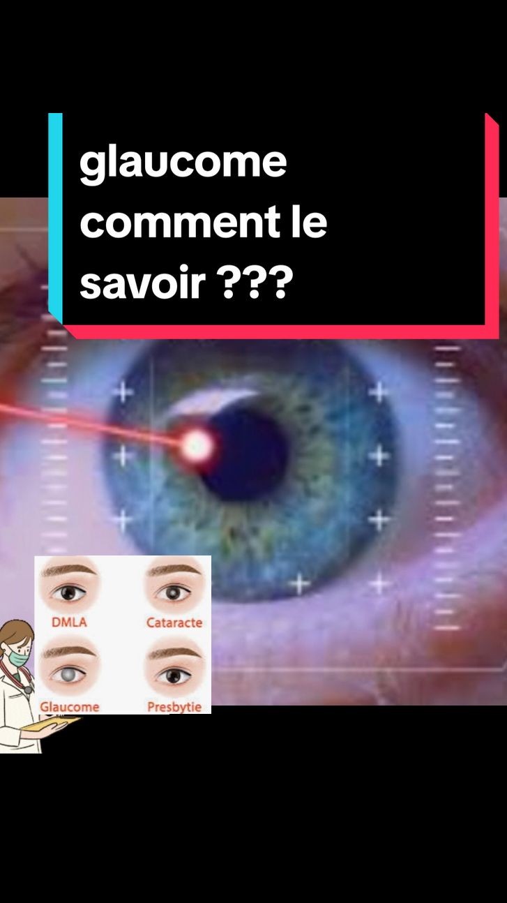 glaucome comment le savoir? Le glaucome est une maladie de l’œil associée à la destruction progressive du nerf optique, le plus souvent causée par une pression trop importante à l’intérieur de l’œil. Cette pathologie constitue la seconde cause de cécité dans les pays développés. A ce jour, des traitements permettent de stopper son évolution mais ils ne permettent pas de restaurer la vision lorsque la maladie est déjà évoluée. Le dépistage précoce du glaucome est donc primordial.#medicine #medical #maladie #santé #glaucome#tension#france #tiktok #apprendre #explore @Lève-Toi Femme 