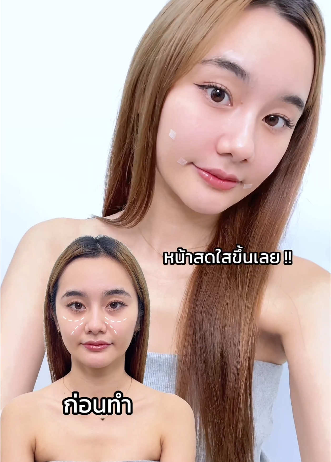 อัพความละมุนสวยพุ่งที่ #lbcclinic !😍💗 #รีวิวบิวตี้ #tiktokบิวตี้ #tiktokป้ายยา #ป้ายยา #fyp #fypシ゚ #หน้าละมุน #หน้าเด็ก 