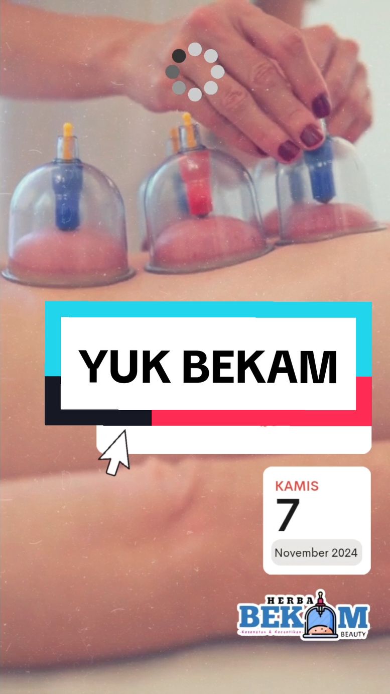 #sunnahrasul #sunnah #bekamangin #bekamdarah #bekamdarahkotor #cupping #cuppingtherapy #cuppingmassage #hijama #hijamah #hijamatherapy #bekampria #bekamwanita #bekamjakarta #bekamdepok #bekambekasi #bekambintaro #bekamtangsel #bekam #bekambandung #bandung #bandunghits #bandunginfo #jakarta 