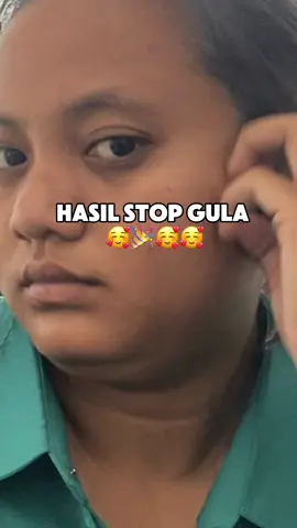yuk stop gula ❤️ mari diet, skincare , mari merawat diri ❤️ #diet #dietsehat #diettips #dietas #dietjourney #dietaketo #perjalanandiet #GlowUp #glowingskin #glow #sakithati #moveon #diet 