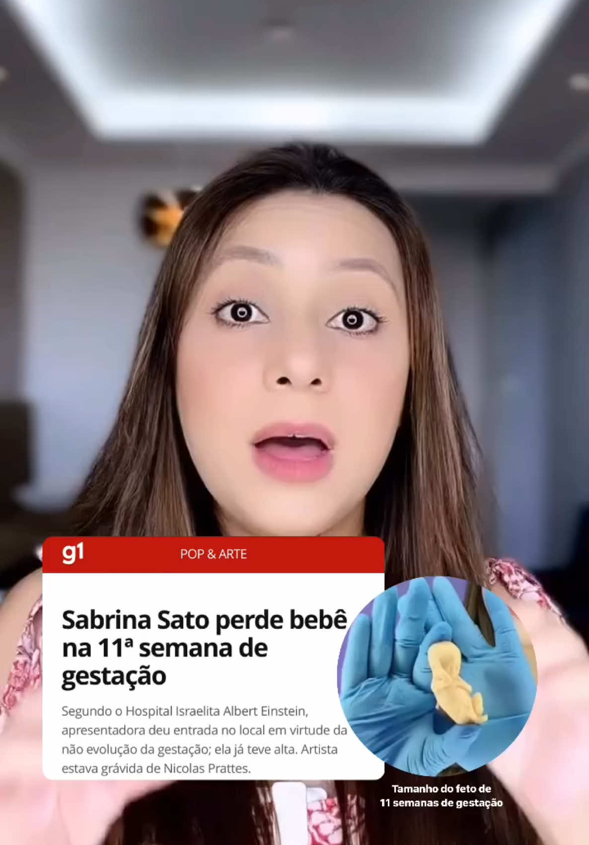 É com muita tristeza que recebemos a notícia da perda gestacional de Sabrina Sato. O início da gravidez é um período extremamente delicado, pois ocorre uma rápida duplicação celular que precisa acontecer sem erros. Alterações genéticas e cromossômicas são a principal causa de perdas gestacionais e, nesses casos, o corpo naturalmente interrompe a gravidez. Não é culpa da gestante; é um processo fisiológico que preserva o desenvolvimento saudável. Nossos pensamentos estão com a Sabrina e sua família neste momento de dor.