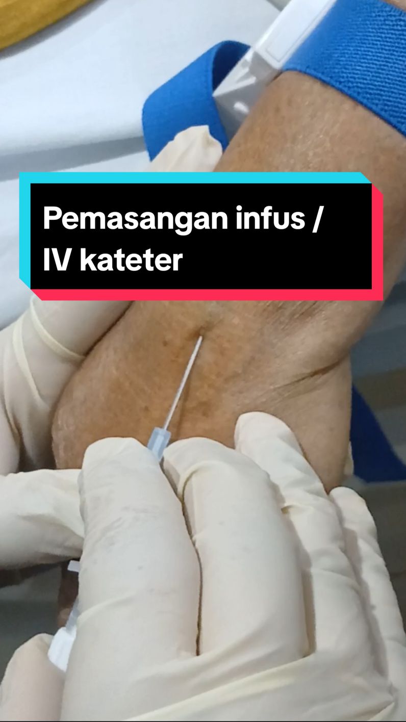 Infus atau pemasangan IV kateter adalah prosedur medis untuk memasukkan selang plastik ke dalam pembuluh darah pasien agar dapat#HCU #perawatindonesia #keperawatan💊💉 #menyalaicu🔥🔥🔥 #pasanginfus  memberikan terapi intravena. Cairan infus, obat, atau transfusi darah dapat dialirkan melalui selang infus tersebut.