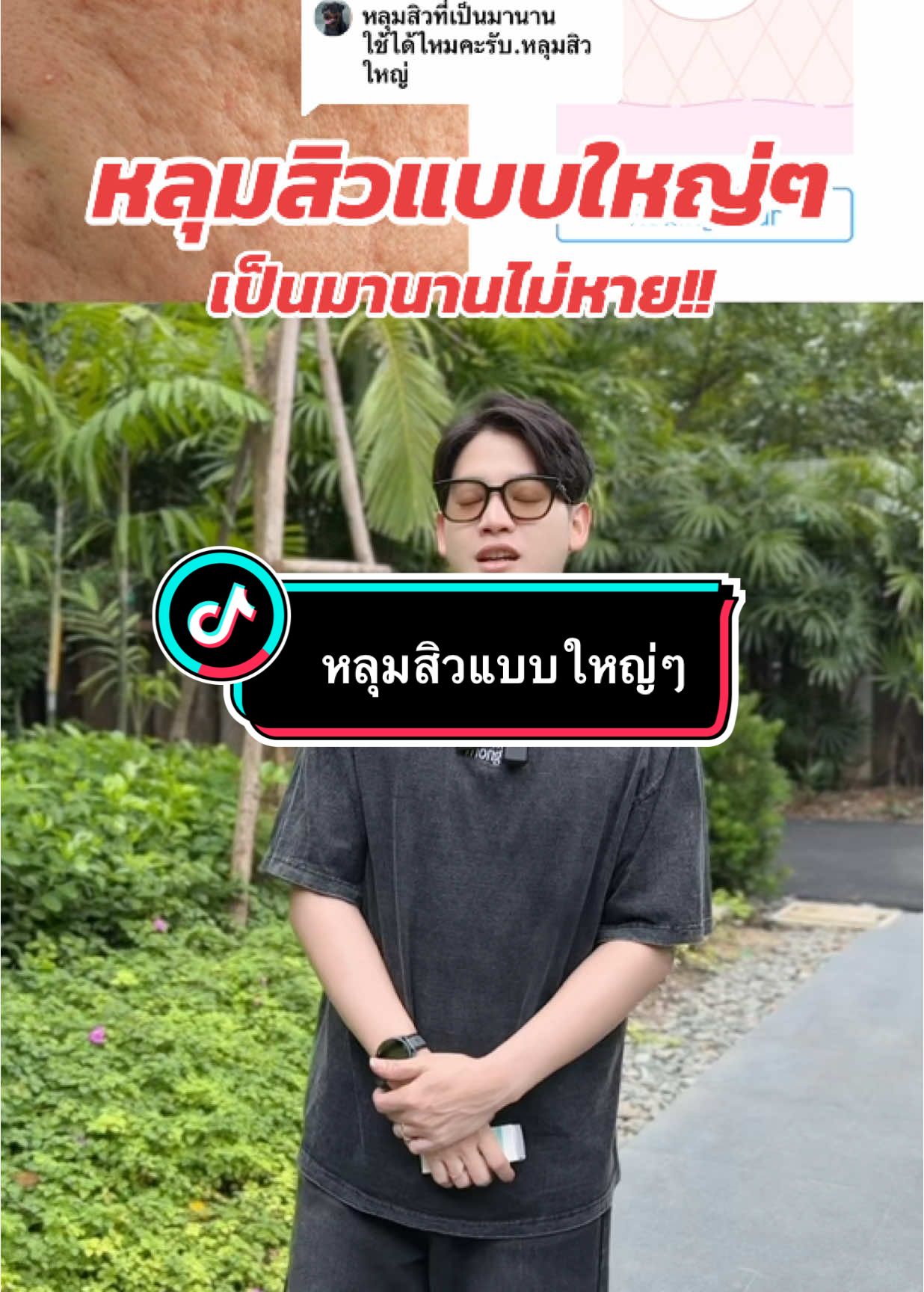 ตอบกลับ @kookkookkai #สิว #หลุมสิว #รูขุมขนกว้าง #ยันฮีโปรเอกโนเซรั่ม #สต๊าฟยันฮี #ps654 