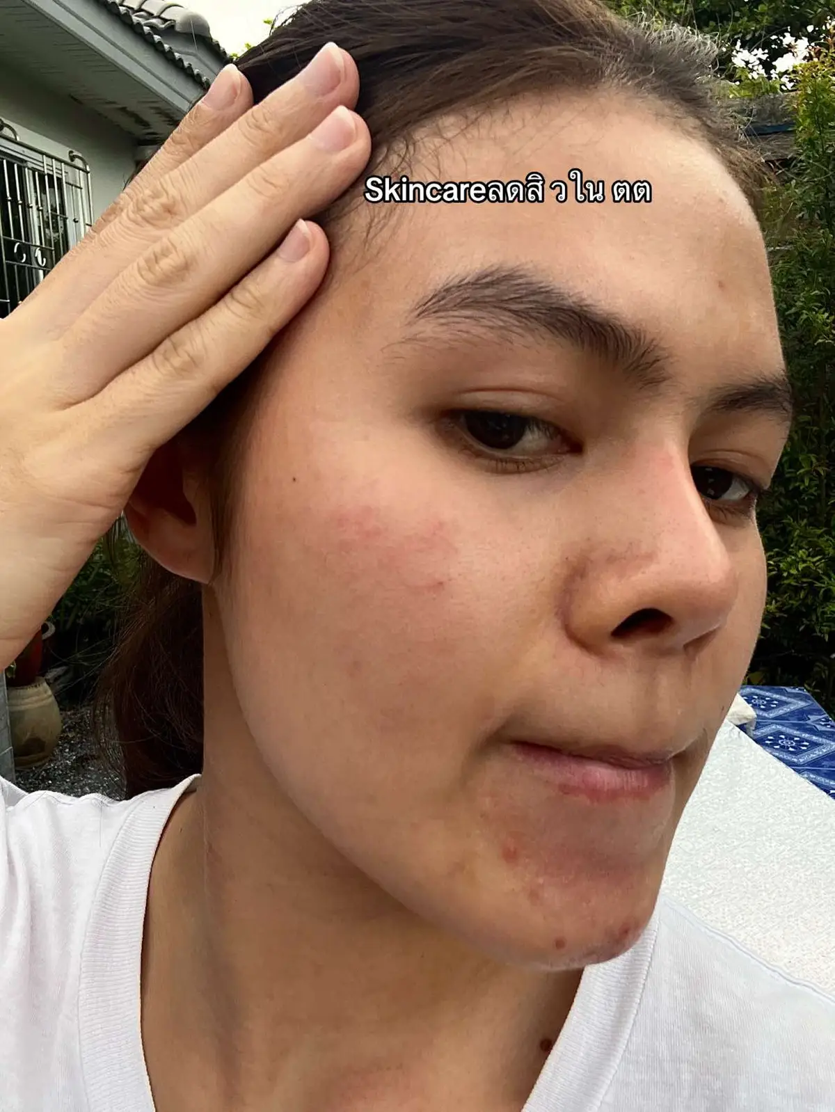 #ครีมน้ํานมข้าว #ครีมน้ํานมข้าวสุรนุช #ครีมลดสิว #skincare #ฟีดดดシ 