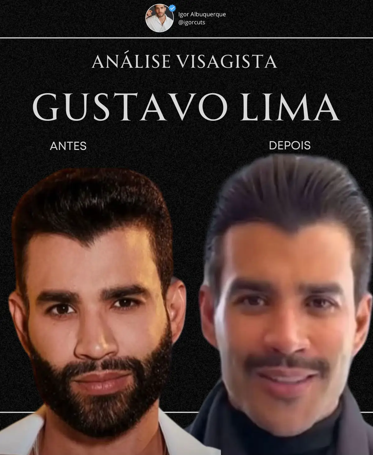 Novo estilo visual fo gustavo lima. 