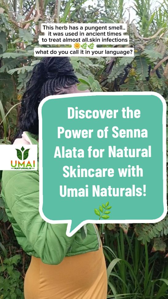 🌿 Discover the Power of Senna Alata for Natural Skincare with Umai Naturals! 🌿 Are you looking for an all-natural remedy for skin health?Meet Senna Alata nature's powerful skincare solution, celebrated for centuries for its incredible skin-healing properties. Known for its potent anti-fungal, anti-bacterial, and anti-inflammatory properties, this powerful plant has been trusted for generations to address various skin infections and enhance overall skin health. Why Senna Alata for Skincare? Senna Alata, also known as the 