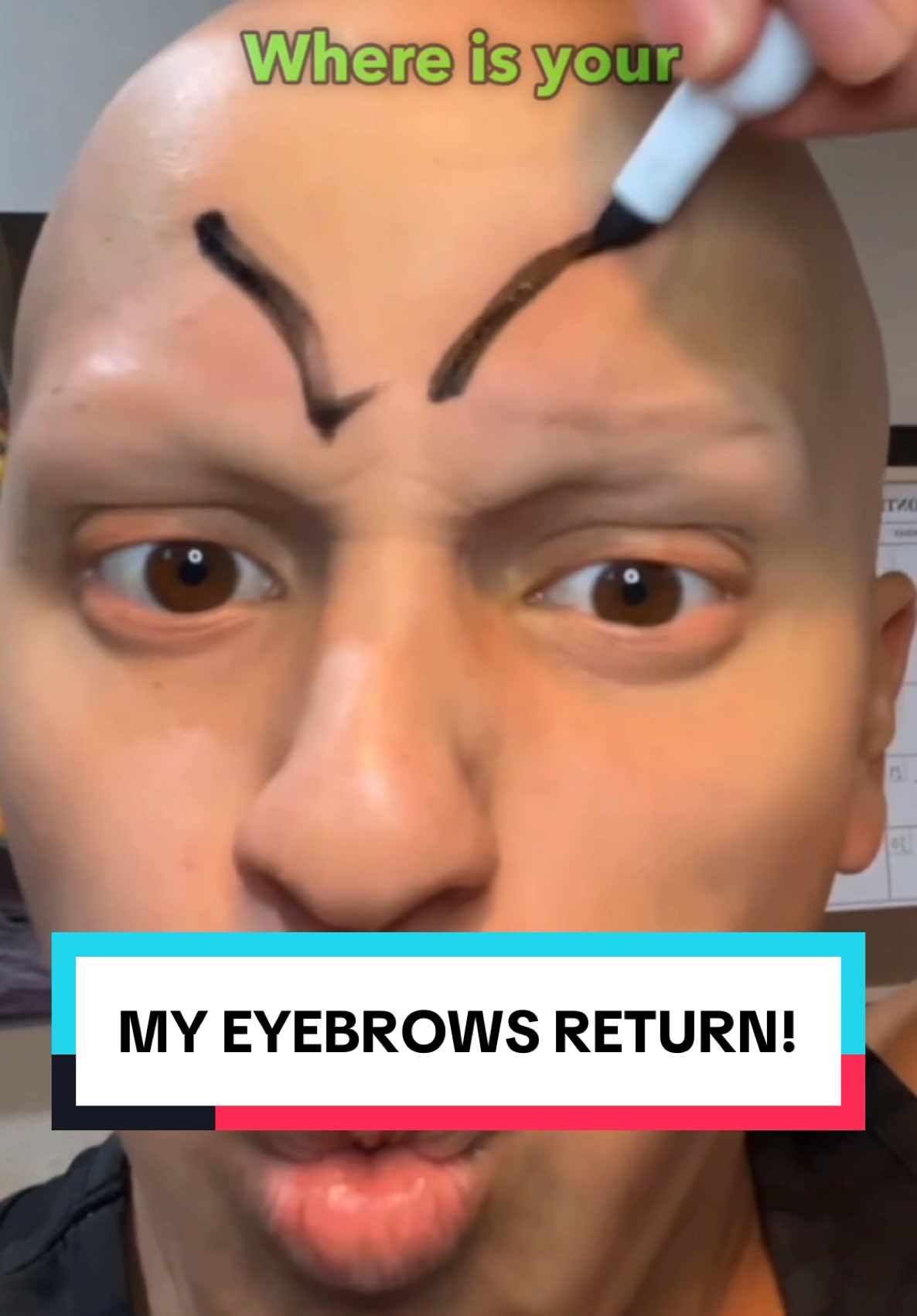 MY EYEBROWS RETURN!🥰😱 #comedy #funny #lol #alopecia 