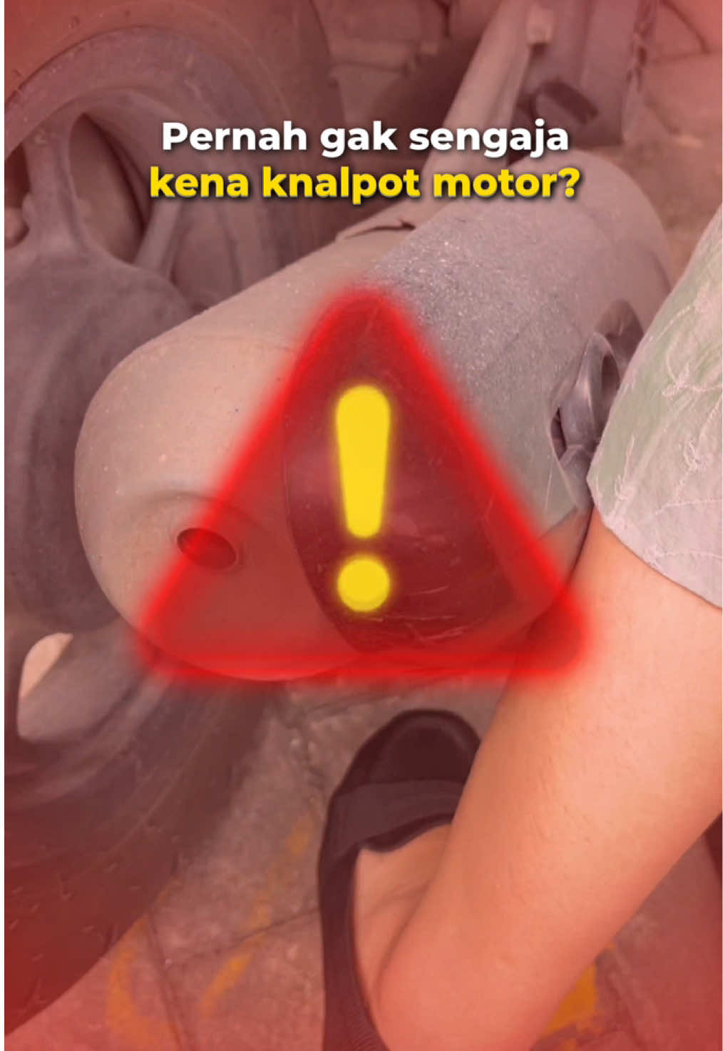 Suka panik kalau ada bekas luka knalpot ataupun bekas luka lainnya yang bikin kamu insecure? Tenang, KeloPlast siap bantu hilangkan bekas luka kamu!🦸🏻‍♀️ #keloplast #plesterluka #plesterbekasluka #bekasluka #penghilangbekasluka #keloid 