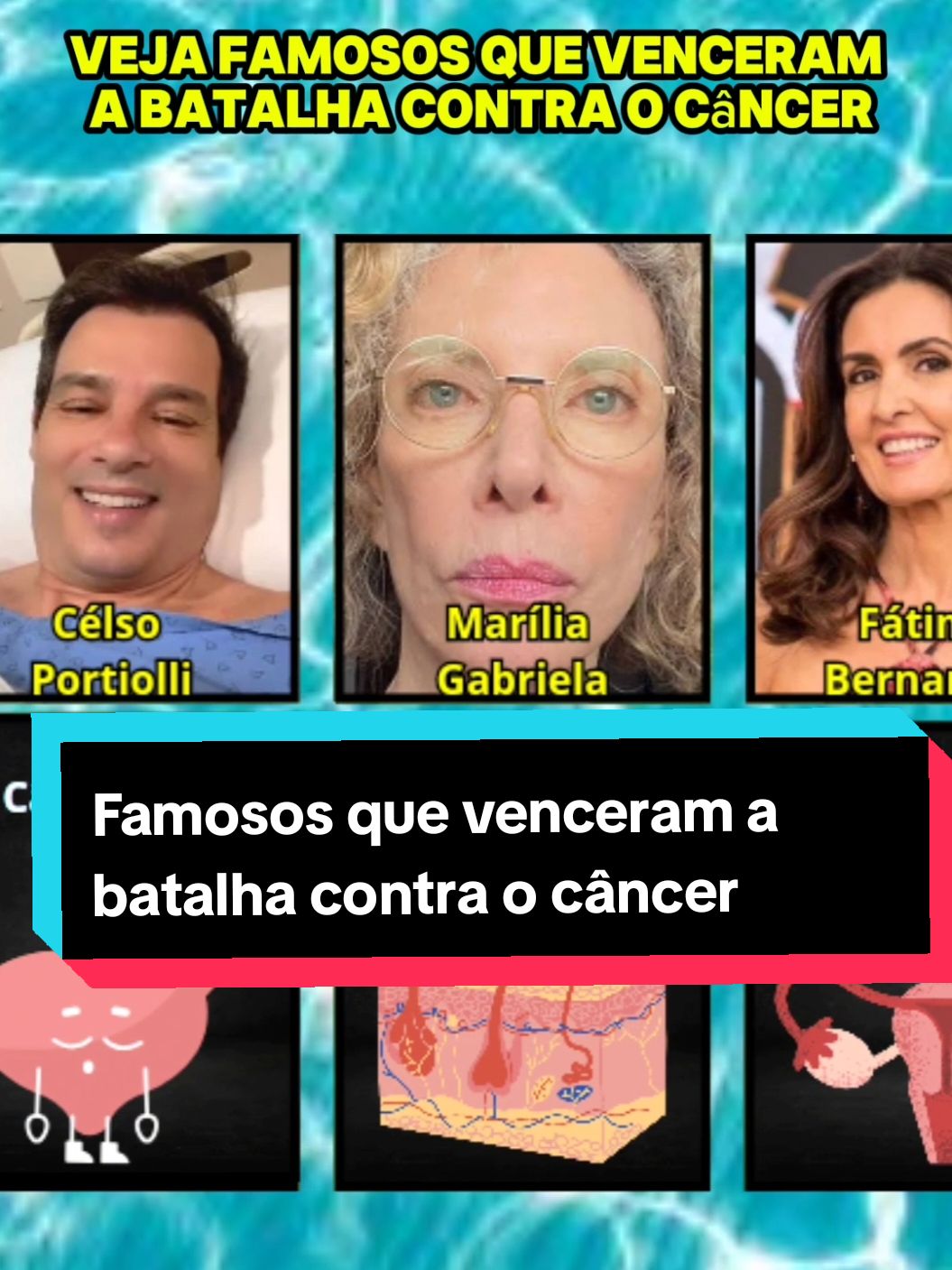 Famosos que venceram a batalha contra o câncer 🥹. . . .  . . . . . #fofoca #milagre #cura #cancer #saude #famosos #medicina #deus_no_controle #deusnocomando 