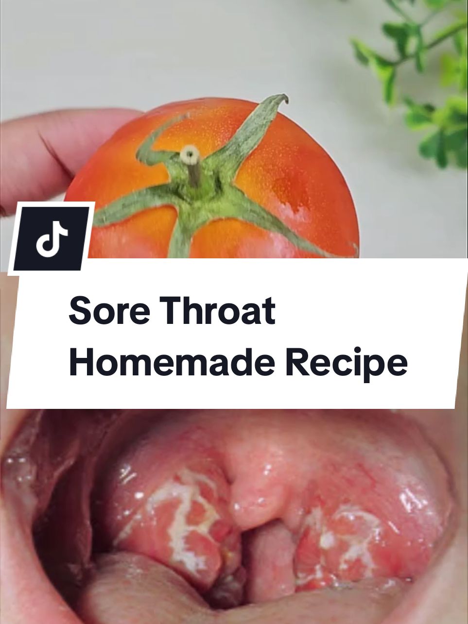 if your throat hurts so much that you canette even swallow you own saliva, you need to try this. if your throat hurts, and medication isn't working for you, try this, and you'll thank me #sorethroat #sorethroatremedy #relief #pain #sorethroatrelief  . . Sore Throat Homemade Recipe.  Fix Your Sore Throat Overnight With this natural Recipe.  #naturalremedy #naturalremedies #remedy #recipes #Recipe #usa🇺🇸 #american #UK #irland #england🇬🇧 