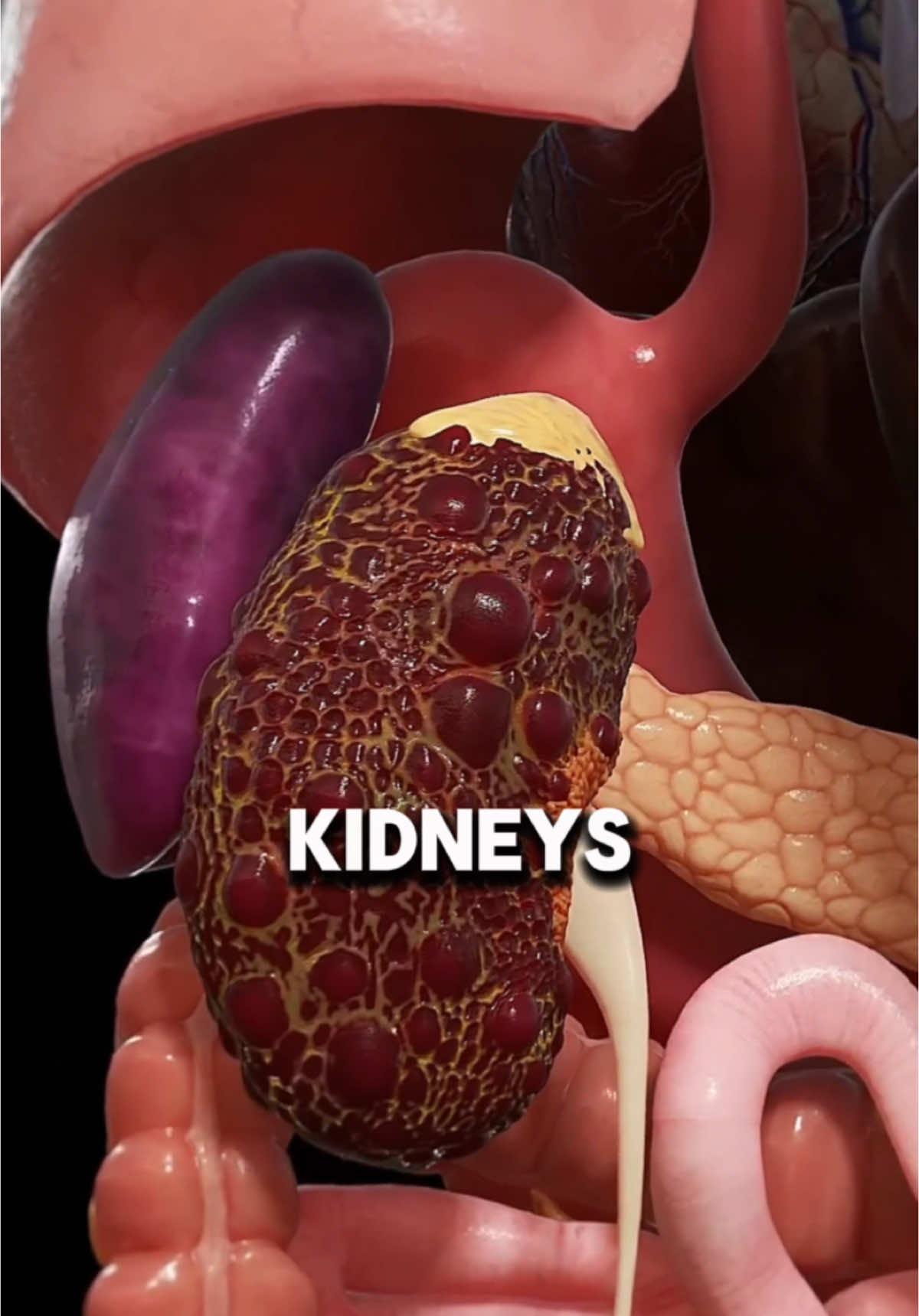 Six fruits That will clean your kidney. This is important. #fruits #usa🇺🇸 #usatoday #kidneyfailure 