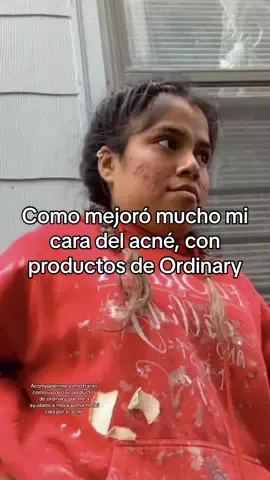 #the #acne#@The Ordinary #skincare #skincare #the #acneskincare #😊 #acne#cuidatupiel #skincare 