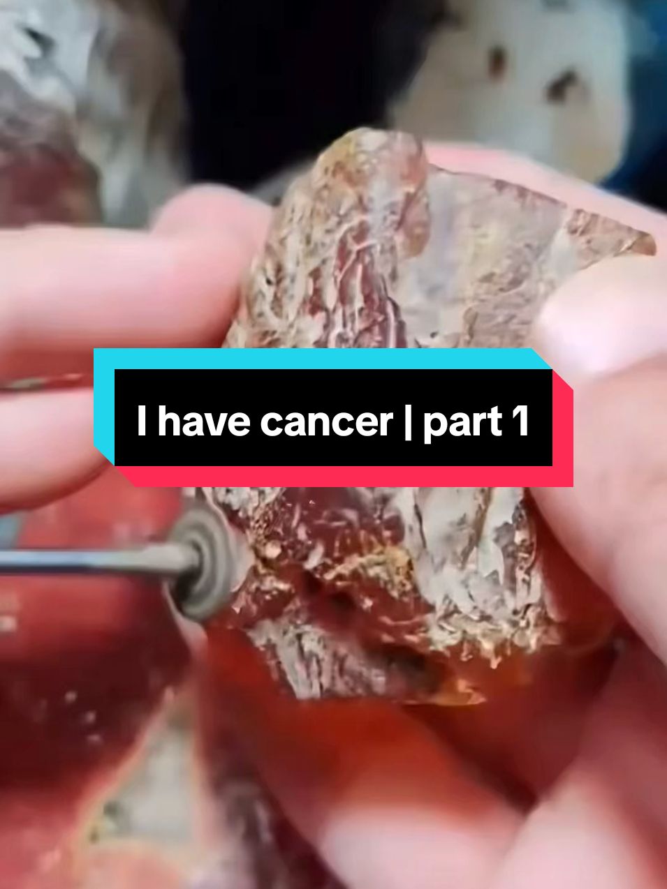 I have cancer | part 1  #textmessage #textingstory #redditstorytime #scary #reddit_tiktok #redditreadings 