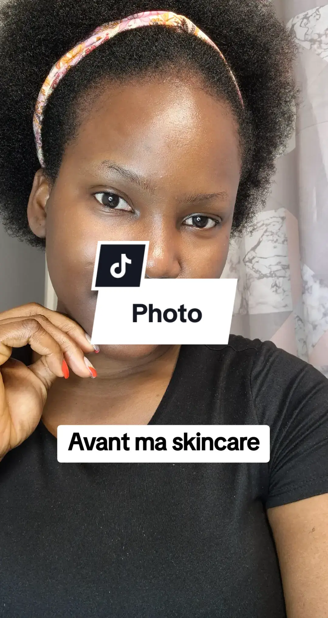 Tu ne peux que avoir une belle peau à la longue 🥰🥰🥰 #ihannashop #skincare #BeautyTok #soinvisage 