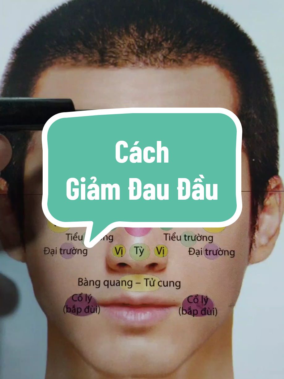 Giảm đau đầu ngay và luôn #xuhuongtiktok2024 #suckhoe #bamhuyet #đaudau #thatvidieu 