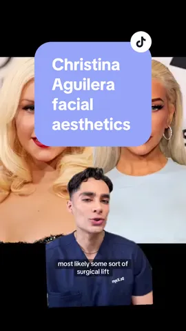 Christina Aguilera facial aesthetics  She is looking rather different these days and seems to have lost weight. Her face in particular is also looking rather snatched. Purely speculation and just my opinion but it seems as though she may have had some work done recently.  What do you think? 💬 Leave your comments below 👇🏼  #Christinaaguilera #facialaesthetics