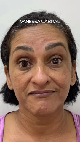 💎harmonização individualizada💎 Aprimorando o conceito de harmonização facial, Rejuvenescendo cada paciente de forma única, sem perder sua identidade. . . . #clinicavanessacabral #vanessacabral #harmonizaçãofacial #acidohialuronico #esteticafacial #rejuvenescimento #colageno #beauty #autoestima 