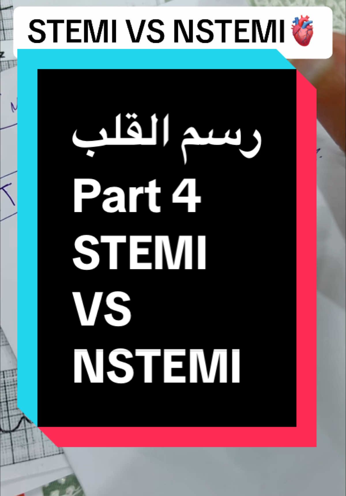 رسم القلب الجزء الرابع ECG STEMI vs NSTEMI #drmsanotes #طب #fyp #السعي #medicine #الاستمرارية #fyp #cardiology #study #ecg #gp #usmle #