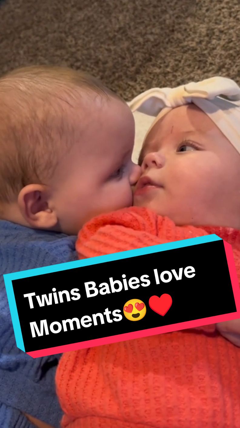 Twins Babies love Moments😍♥️ #baby #lovemoment #twins #babiesoftiktok #twins #twinbrothers #twinbabies #twinmom #twinsoftiktok #cutebaby #viral_video_tiktok #tik_tok #moments #Love #1m #babysoftiktok #cute #twinsoftiktok #fypppppppppppppp #fyp #Fyp 