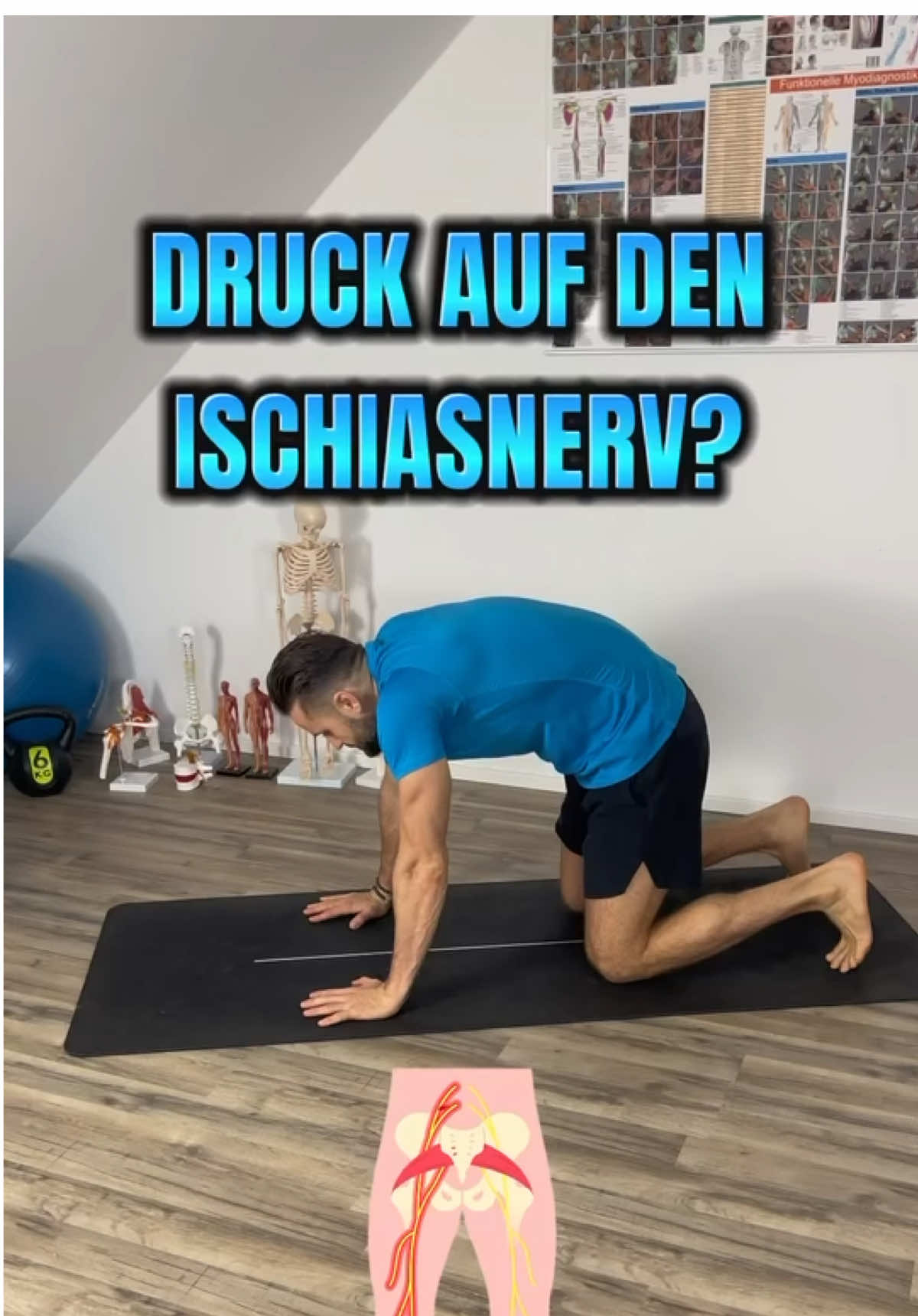 Druck auf den Ischiasnerv? #dkhealth #ischias #ischiasschmerzen #ischiasnerv #piriformis #gesund #fit