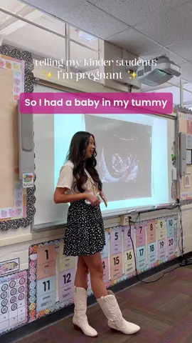 how i told my kindergarten students i’m pregnant 🤰🏻✨ #teachertiktok #teacherblogger #teachertok #tiktokteacher #teachersontiktok #pregnant #pregnanttiktok #pregnanttok #pregnancyannouncement 