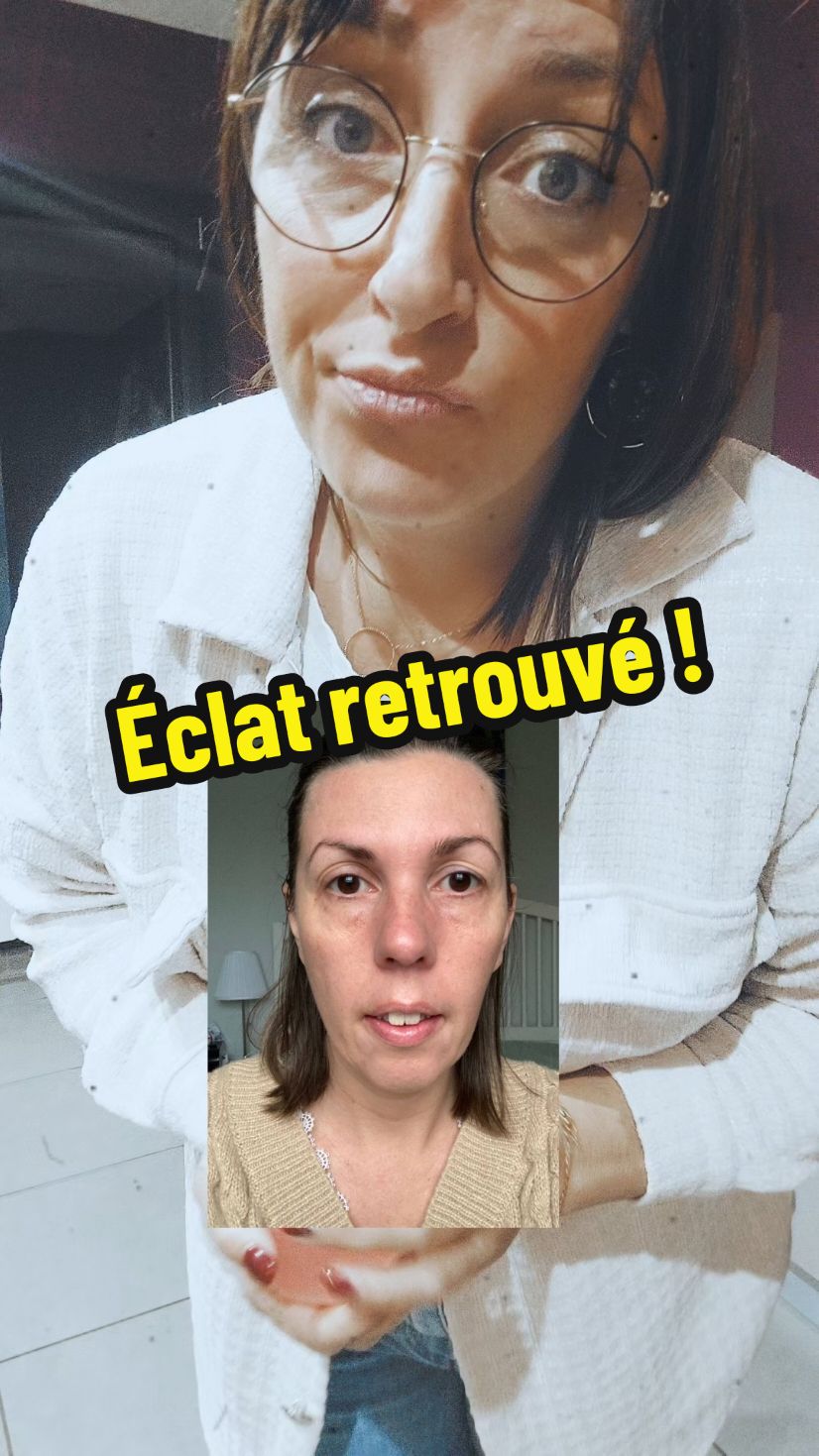 L'incroyable transformation de peau en seulement 2 mois, malgré les défis de l'âge et du tabac ! Comme quoi, il n'est jamais trop tard pour retrouver de l'éclat. 🌟 #TransformationPeau #SoinVisage #RoutineAntiAge #PeauÉclatante #AvantAprès #ConseilsBeauté 