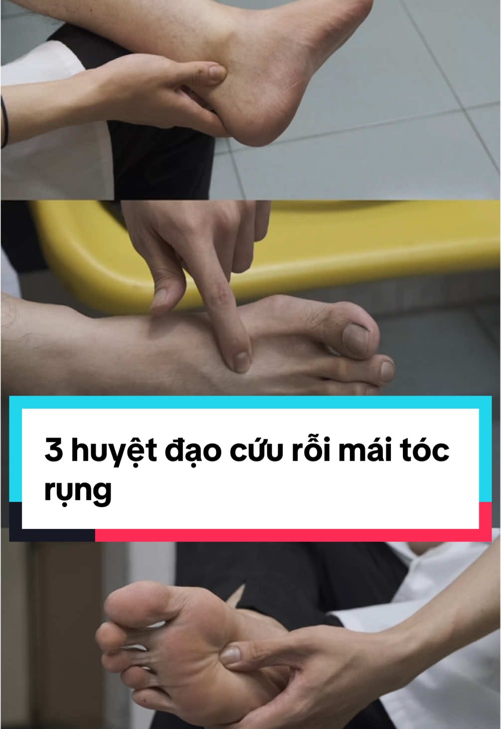 3 huyệt đạo cứu rỗi mái tóc rụng #duongsinh #hoadadongy#rungtoc#bothan 