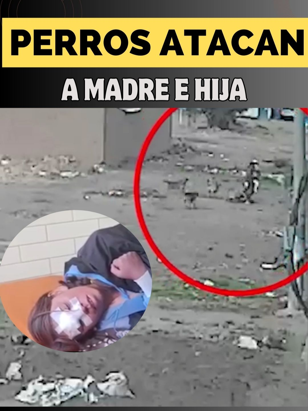 Madre salvó a su hija de ataque de perros callejeros #perros #juliaca