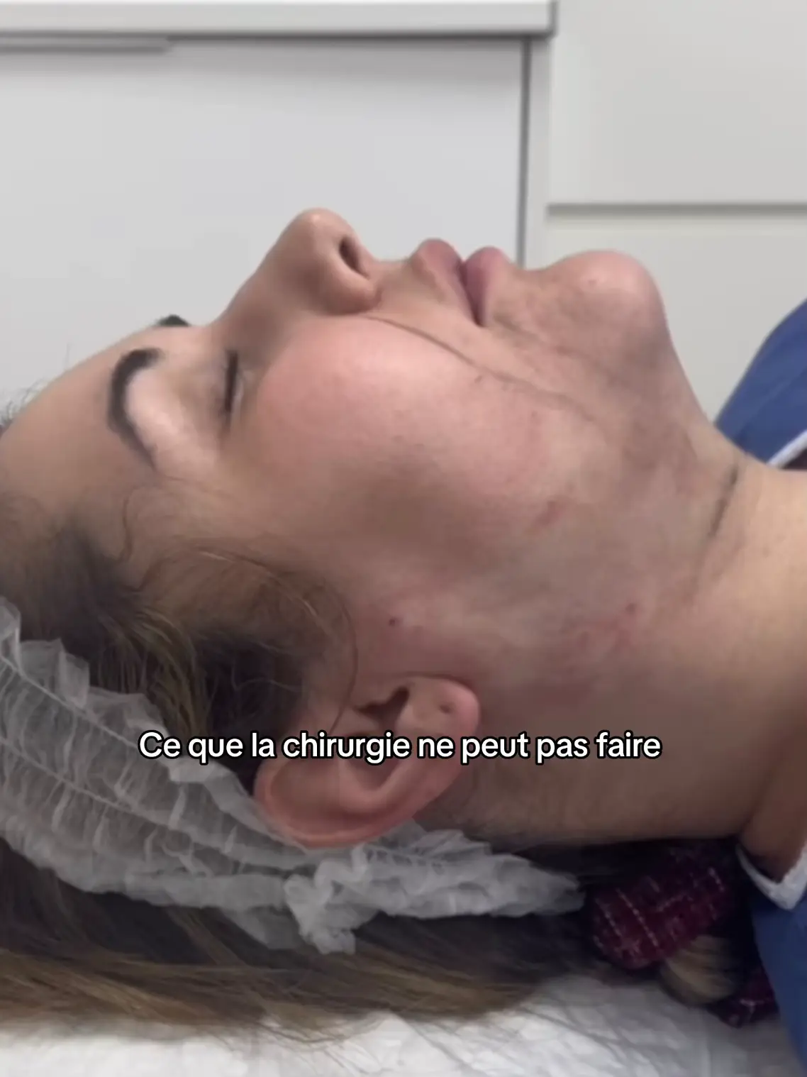 Le traitement par laser Endolift s’applique autant aux femmes qu’aux hommes qui souhaitent remodeler leur visage. En revanche, pour obtenir un résultat satisfaisant, le relâchement cutané ne doit pas être trop important (auquel cas il vaut mieux recourir à un lifting chirurgical du visage) et les amas graisseux trop excessifs (une liposuccion sera alors plus adaptée). * Bord mandibulaire, * Bas joues, * Ovale du visage, * Plis d’amertume, * Double menton, * Paupières inférieures (correction des poches), #chirurgienesthetique #chirurgie #liposuccion #endolift #jawline  * Cou Vous pouvez le faire sous anesthésie locale