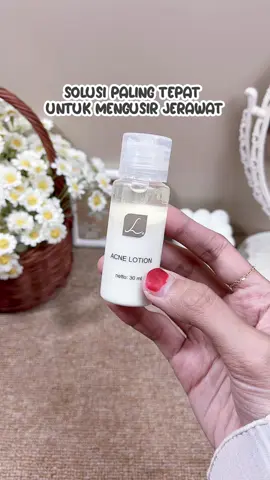 Jangan galau lagi kalau punya jerawat, karena udah ada acne lotion ini😍💖✨ #acnelotion #acnefighter #acnetreatment #acneproneskin #obattotoljerawat #obattotoljerawatviral #obatje#obatjerawatampuh #lotionjerawat #jerawat #jerawathilang #racunintiktok #viralditiktok #cuantanpabatas #gebyarbelanjanovember #guncanggajian #gajiansale #fyp #fypage 