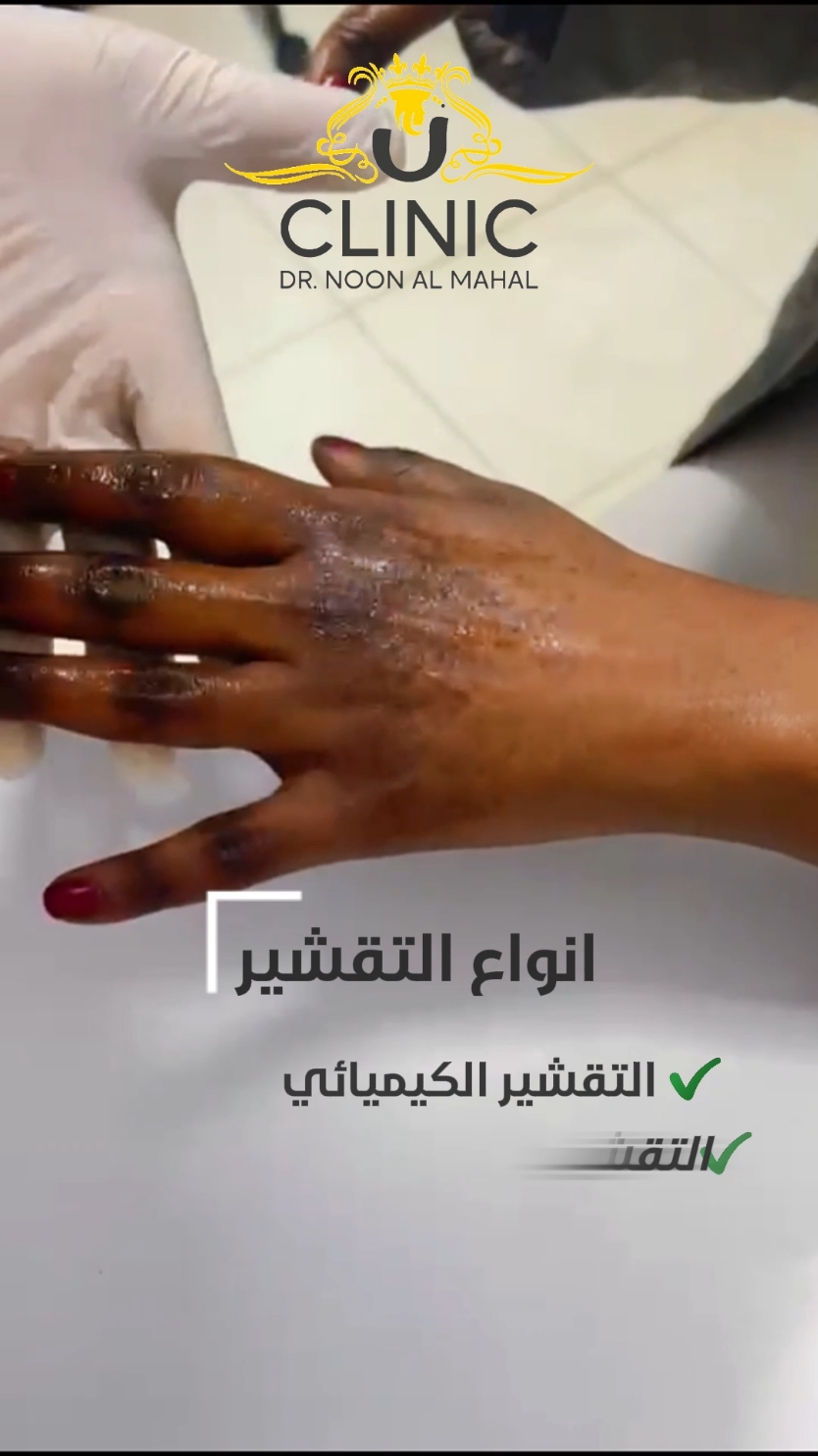 #نون_المهل  #تقشير  #peeling  #التقشير_البارد  #تجميل   #نضارة   #عناية_بالبشرة    #بشرة   #sudanese_tiktok  #مشاهير_السودان  #السودان #مصر🇪🇬 مصر #مدينة_نصر #القاهرة 