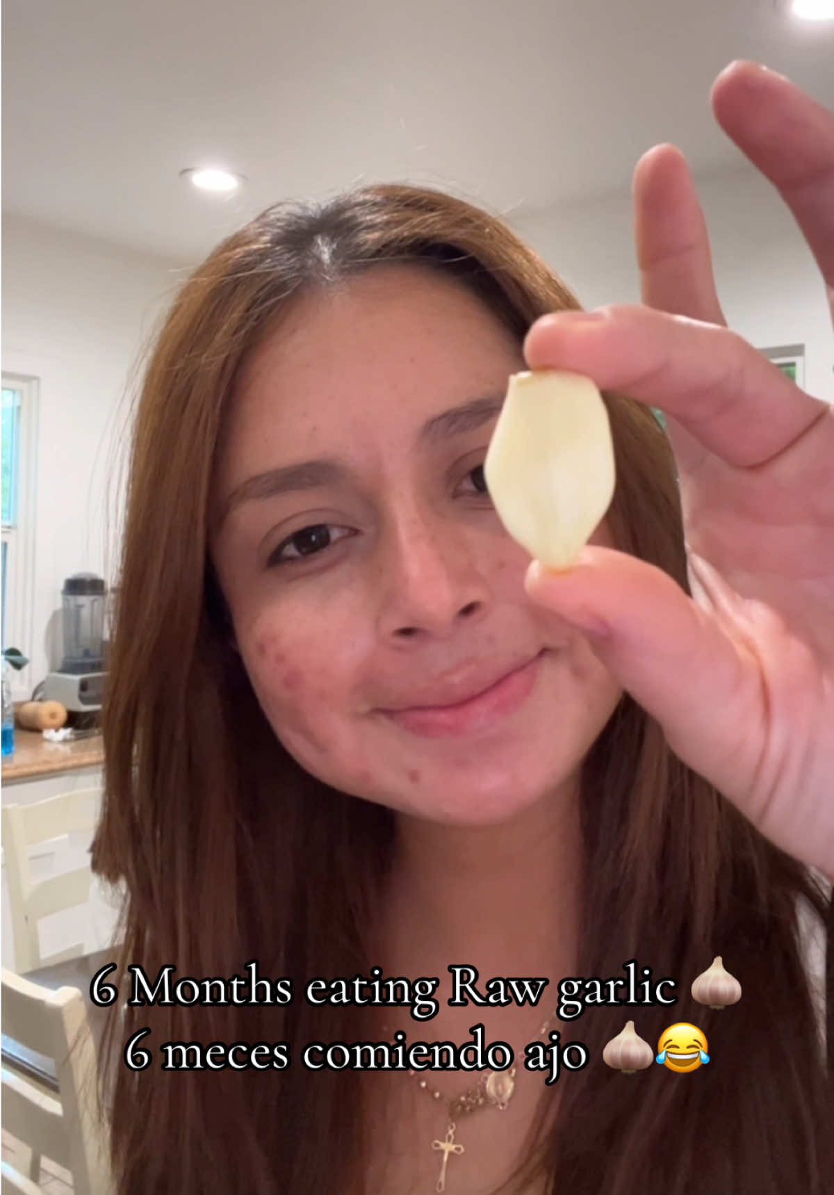 6 months eating raw garlic and more to come 🧄🧄😋#acne #rawgarlic #garlic #ajo #acneproneskin #garlictrend #pielconacne #fyp #fypage 