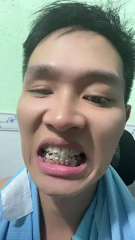#dongkhoangrang #niengrang #minivis #keorang 