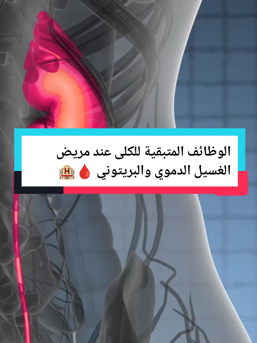 الوظائف المتبقية عند مريض الغسيل الدموي والغسيل البريتوني 🩸🏨 #كلى #غسيل_الكلى #غسيل_كلى #مستشفى #دكتورة #تعلم_على_التيك_توك #LearnOnTikTok #طبيب_تك_توك 