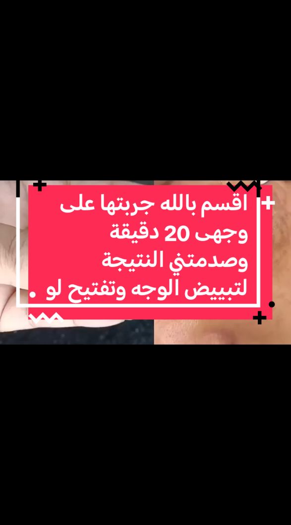 اقسم بالله جربتها على وجهى 20 دقيقة وصدمتني النتيجة لتبييض الوجه وتفتيح لون#1mfollowers #shorts #short #maintain #video #100k #foryoupage #viral #fyp #1mfollowers 