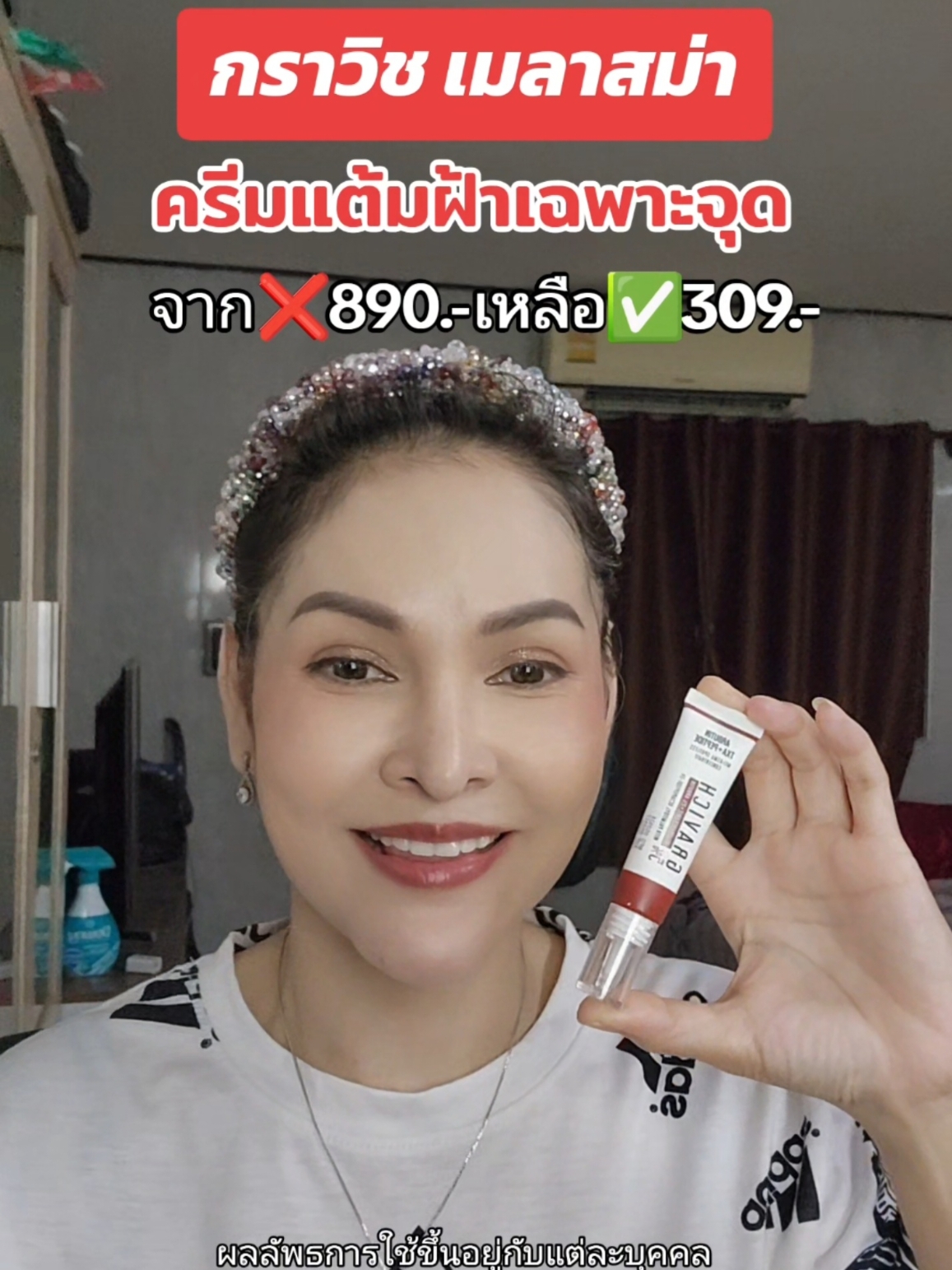 Melasma Spotless Concentrate Cream#gravich #สกินแคร์ #รีวิวบิวตี้ในtiktok #บิวตี้รีวิว #รีวิวบิวตี้ #ของดีบอกต่อ #ครีม #ครีมลดฝ้า 